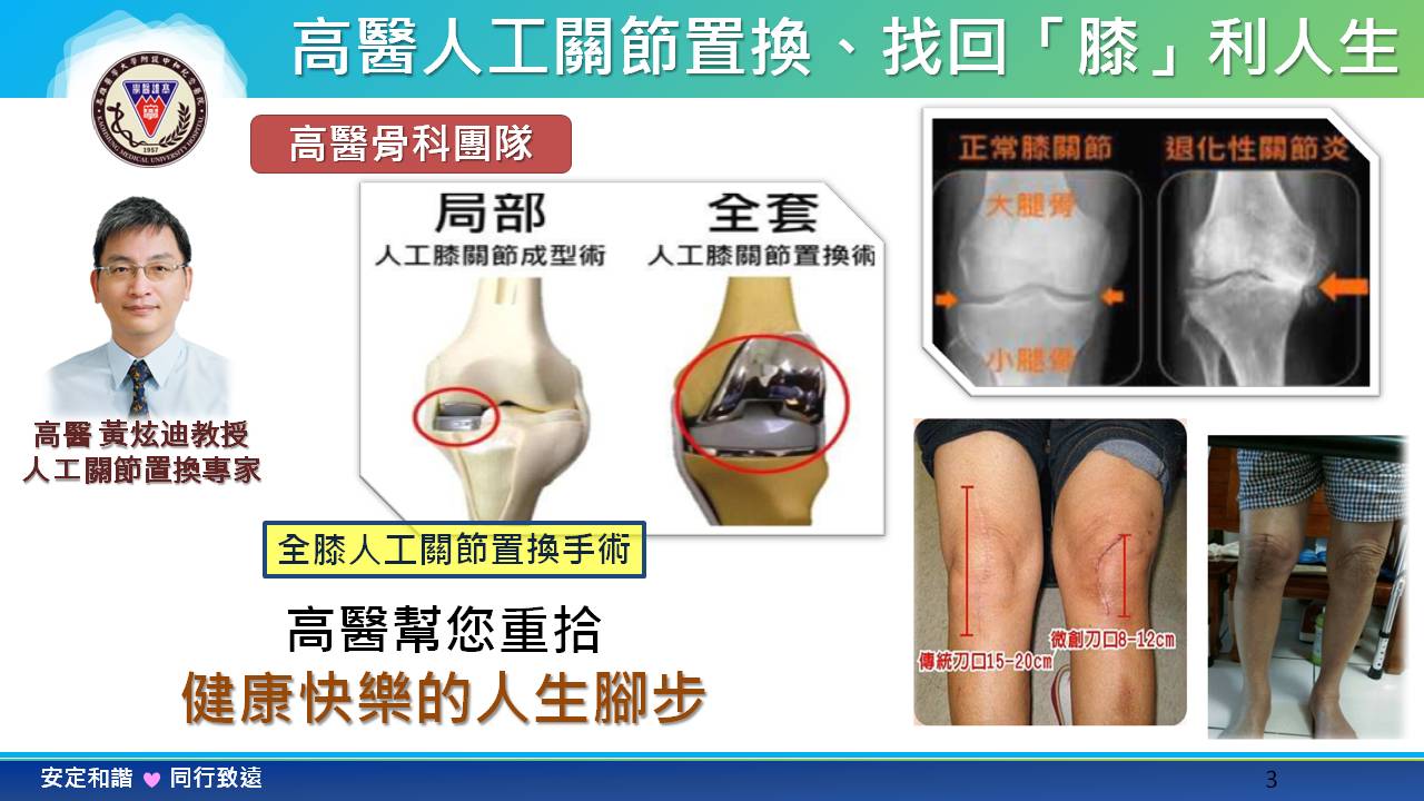 關節置換療