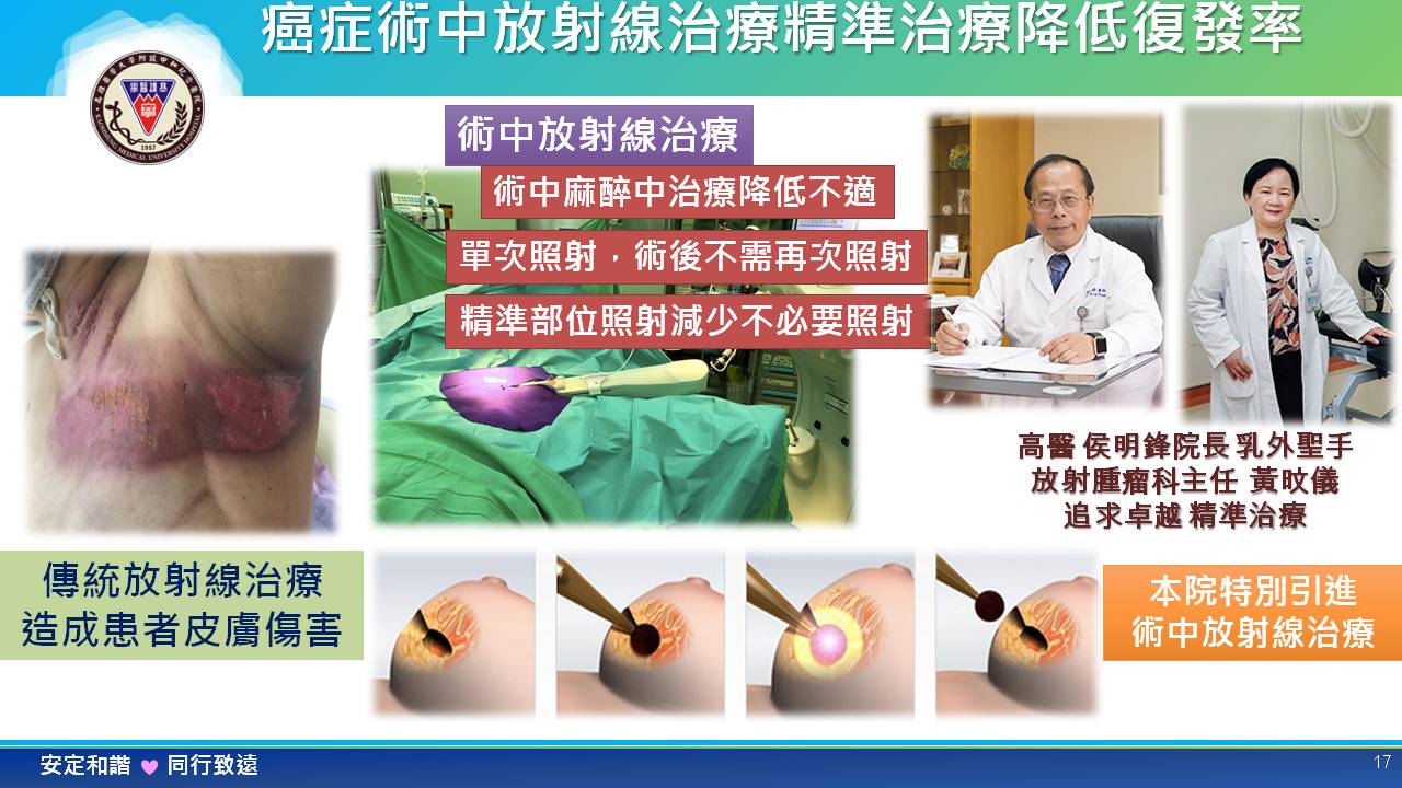 癌症治療