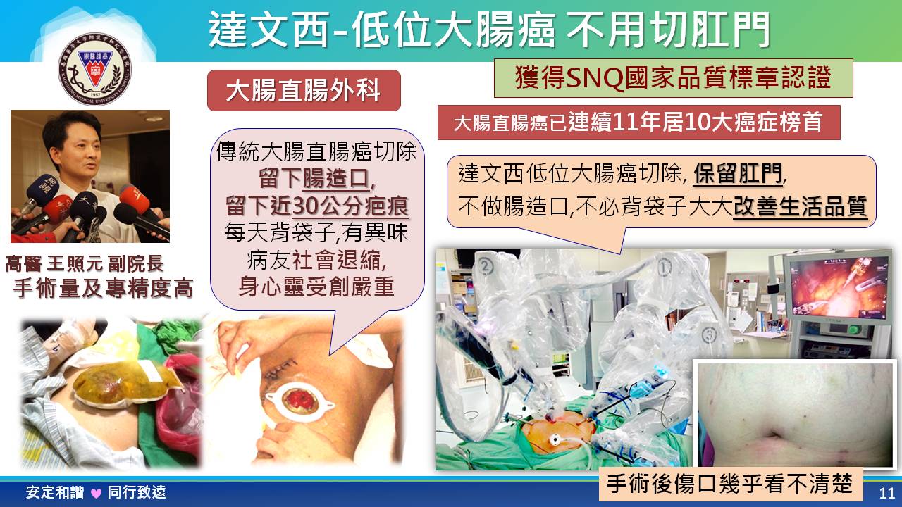 機械手臂手術