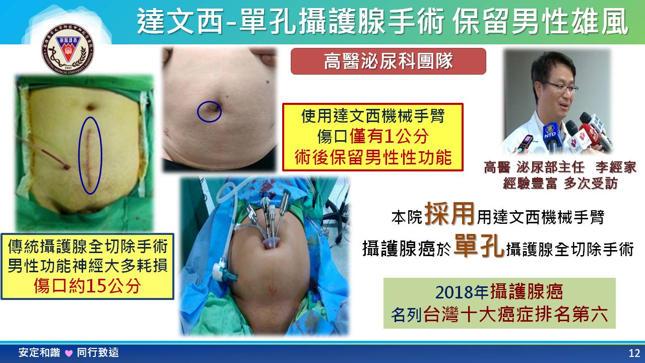 機械手臂手術
